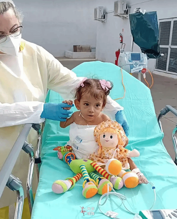 巴西一对连体双胞胎接受分离手术 术后却相继去世